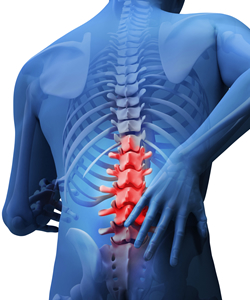 Patient Education: Back and Neck Pain FAQs